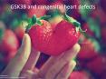 GSK3B and congenital heart defects PowerPoint PPT Presentation