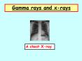 Gamma rays and xrays PowerPoint PPT Presentation