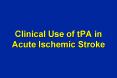 Clinical Use of tPA in Acute Ischemic Stroke PowerPoint PPT Presentation