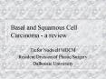 Basal and Squamous Cell Carcinoma a review PowerPoint PPT Presentation