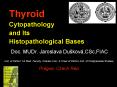 Thyroid Cytopathology and Its Histopathological Bases PowerPoint PPT Presentation