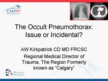The Occult Pneumothorax: Issue or Incidental