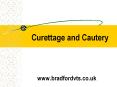 Curettage and Cautery PowerPoint PPT Presentation