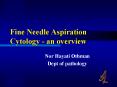 Fine Needle Aspiration Cytology an overview PowerPoint PPT Presentation