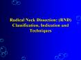 Radical Neck Dissection: RND Classification, Indication and Techniques PowerPoint PPT Presentation