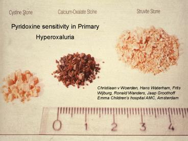 Pyridoxine sensitivity in Primary Hyperoxaluria