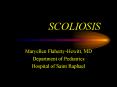 SCOLIOSIS PowerPoint PPT Presentation