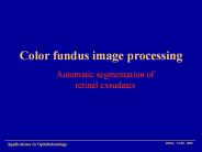 Color fundus image processing