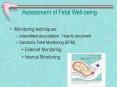 Assessment of Fetal Wellbeing PowerPoint PPT Presentation