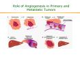 Role of Angiogenesis in Primary and Metastatic Tumors PowerPoint PPT Presentation