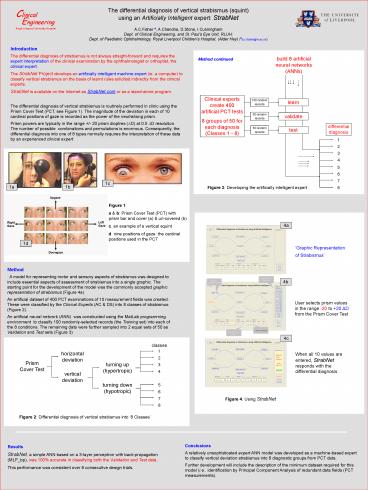 The differential diagnosis of vertical strabismus squint