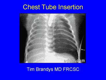 presentation player overlay