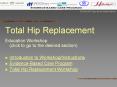 Total Hip Replacement PowerPoint PPT Presentation