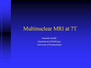 Multinuclear MRI at 7T