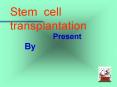 Stem cell transplantation PowerPoint PPT Presentation