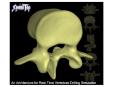 An Architecture for RealTime Vertebrae Drilling Simulation PowerPoint PPT Presentation