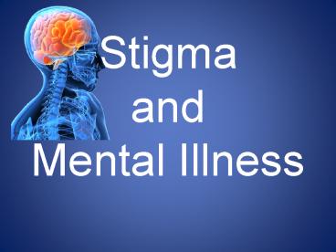 Stigma and Mental Illness