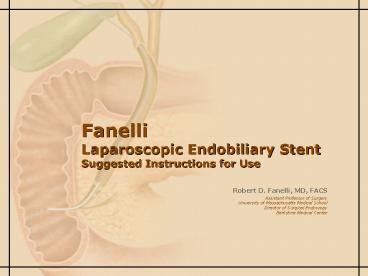 Fanelli Laparoscopic Endobiliary Stent Suggested Instructions for Use