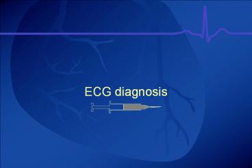 ECG diagnosis