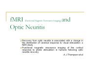 fMRI (functional Magnetic Resonance Imaging) and Optic Neuritis