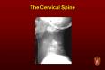 The Cervical Spine PowerPoint PPT Presentation