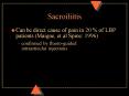 Sacroiliitis PowerPoint PPT Presentation
