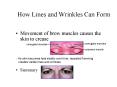 How Lines and Wrinkles Can Form PowerPoint PPT Presentation