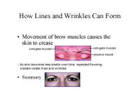 How Lines and Wrinkles Can Form