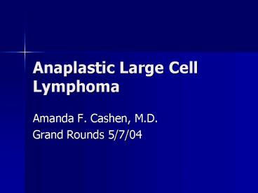 Anaplastic Large Cell Lymphoma