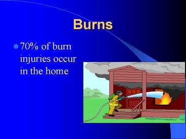 Burns
