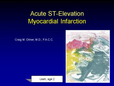 Acute STElevation Myocardial Infarction