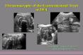 Ultrasonography of the Gastrointestinal Tract in 2004 PowerPoint PPT Presentation