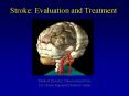 Stroke: Evaluation and Treatment PowerPoint PPT Presentation