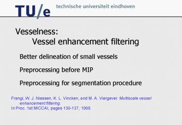 Vesselness: Vessel enhancement filtering