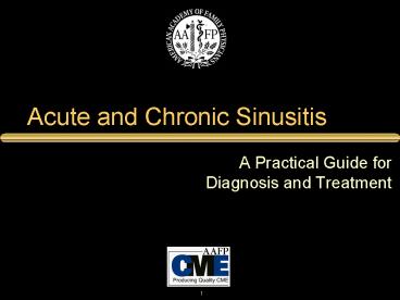 Acute and Chronic Sinusitis
