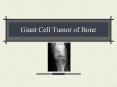 Giant Cell Tumor of Bone PowerPoint PPT Presentation