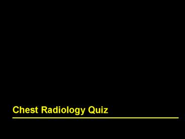 Chest Radiology Quiz