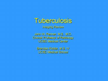 Tuberculosis