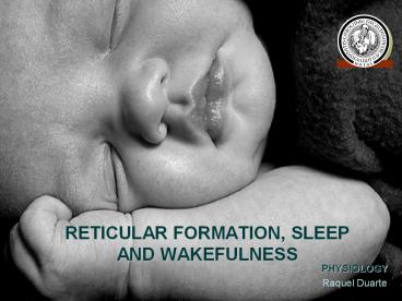RETICULAR FORMATION, SLEEP AND WAKEFULNESS