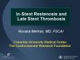 InStent Restenosis and Late Stent Thrombosis PowerPoint PPT Presentation