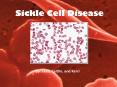 Sickle Cell Disease PowerPoint PPT Presentation