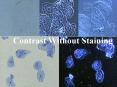 Darkfield Microscopy PowerPoint PPT Presentation