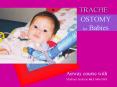 OSTOMY for Babies PowerPoint PPT Presentation