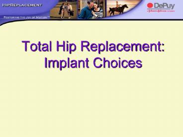 Total Hip Replacement: Implant Choices