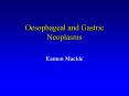 Oesophageal and Gastric Neoplasms PowerPoint PPT Presentation