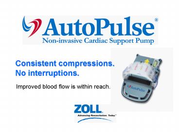 Consistent compressions' No interruptions'