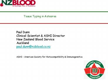 Tissue Typing in Aotearoa