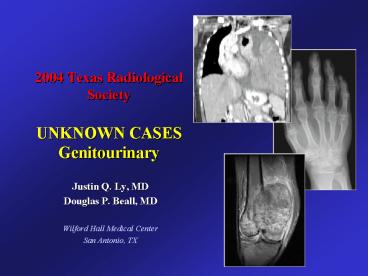 2004 Texas Radiological Society UNKNOWN CASES Genitourinary
