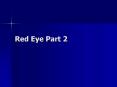 Red Eye Part 2 PowerPoint PPT Presentation