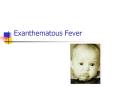 Exanthematous Fever PowerPoint PPT Presentation